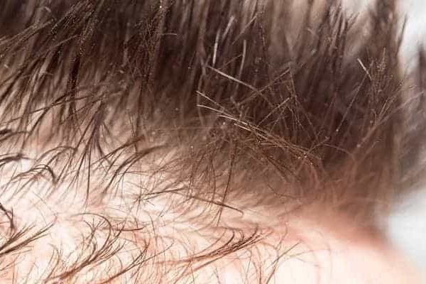 clinique cheveux