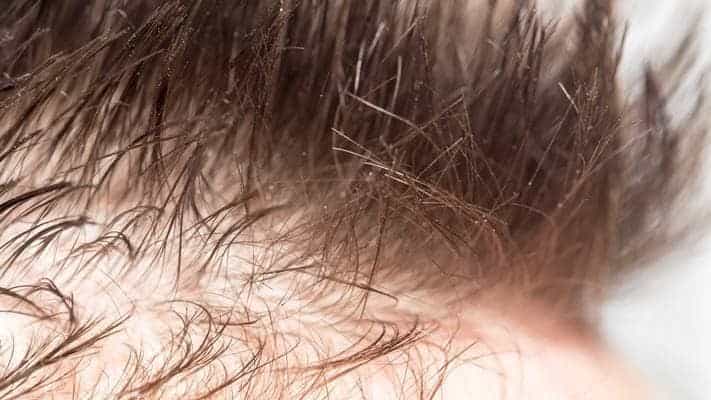 clinique cheveux