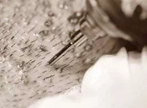 micromotor fue