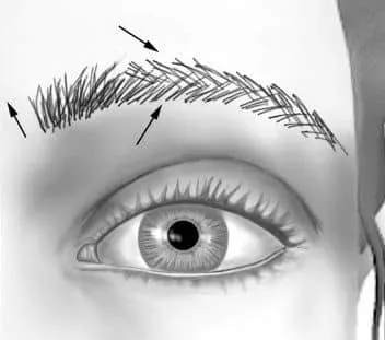 L'importance de l'angle et de l'orientation dans la greffe de sourcils.