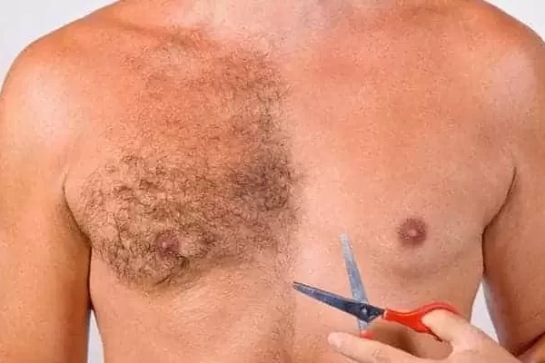 greffe de cheveux avec poils du corps