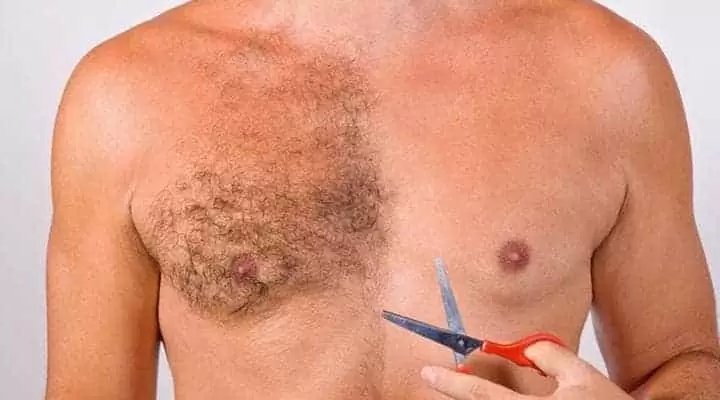 greffe de cheveux avec poils du corps