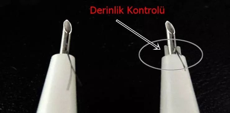 Comparaison détaillée des stylos d'implantation